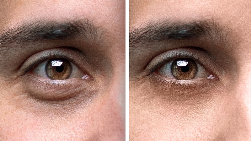 Remove under Eye Bags Photoshop  